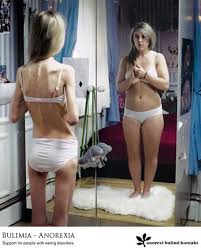 ANOREXIA