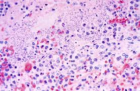 lung tissue