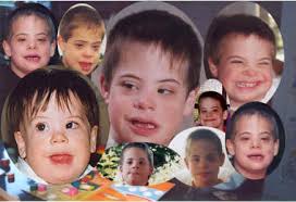 people with down syndrome