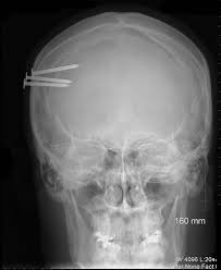 nail gun