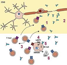viral infections