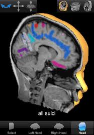 3d brain models