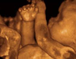 3d 4d ultrasound pictures