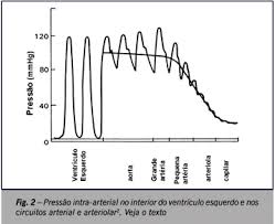 cardiac pump