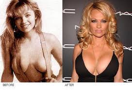 Pamela Anderson