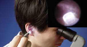 ear cleaning syringe
