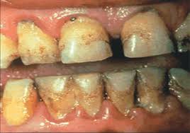 smokeless tobacco products