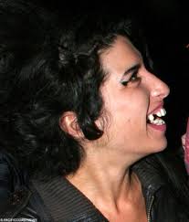 Amy Winehouse Dental Work