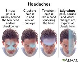 migraine symptoms