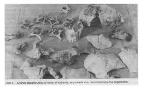 incisiones quirurgicas