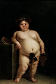 Prader-Willi syndrome is the
