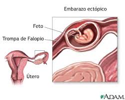infecciones en el embarazo