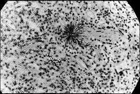 lung tissue