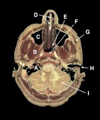 cross sectional anatomy