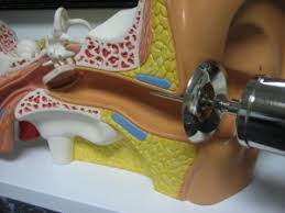 ear lavage syringe
