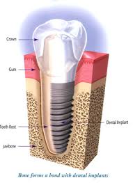 dental pic
