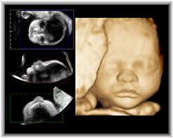 3d 4d ultrasound pictures