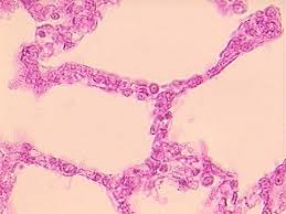 lung tissue
