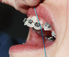 dental floss threader