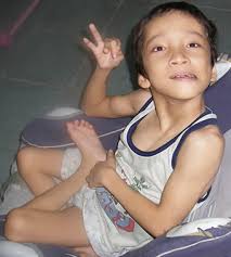 cerebral palsy actually