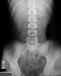 abdominal radiology
