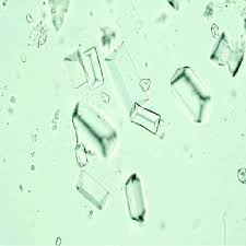 atlas of urinary sediment