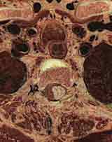 cross sectional anatomy
