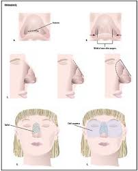 nostril