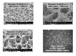 bone tissue