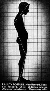 bad posture