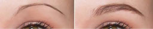 thinning eyebrows