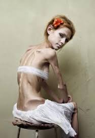 pro ana thinspiration