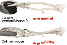 mouse arm