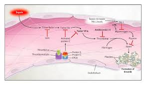 Physiology of Sepsis