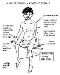 About Polio Virus