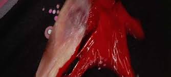 dario argento deep red