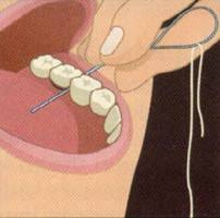 dental floss threader