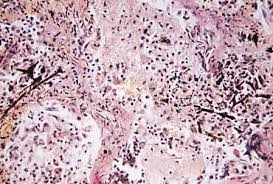 lung tissue