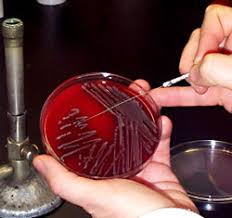 inoculating needle