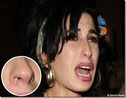 nostril
