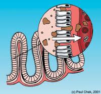 leaky gut syndrome