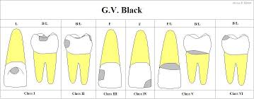 gv black