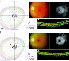 autofluorescence imaging