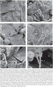 spore germination