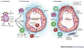 viral infections