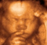 3d ultrasound pictures