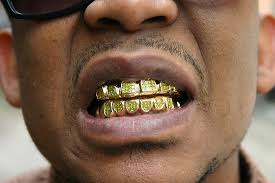 gold teeth
