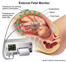 fetal heart rate monitoring