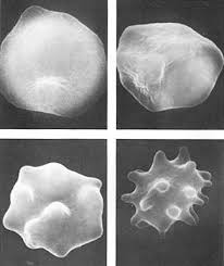 crenation of cells