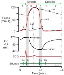 cardiac pressure